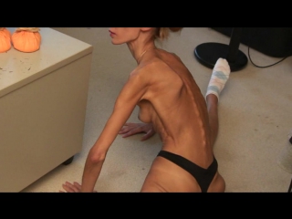 terribly extreme anorexia. naked skinny girls